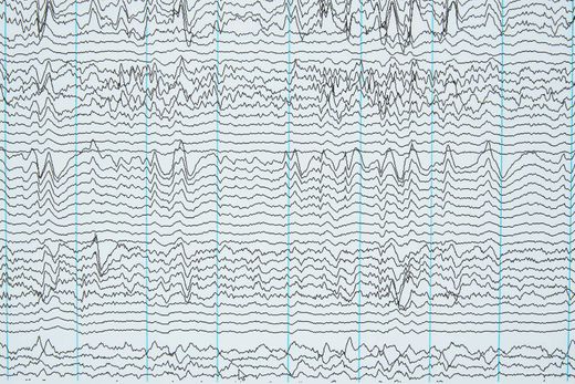EEG Linien
